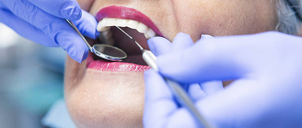 Best Emergency Dentist for Knocked-Out Tooth in Nipomo, CA